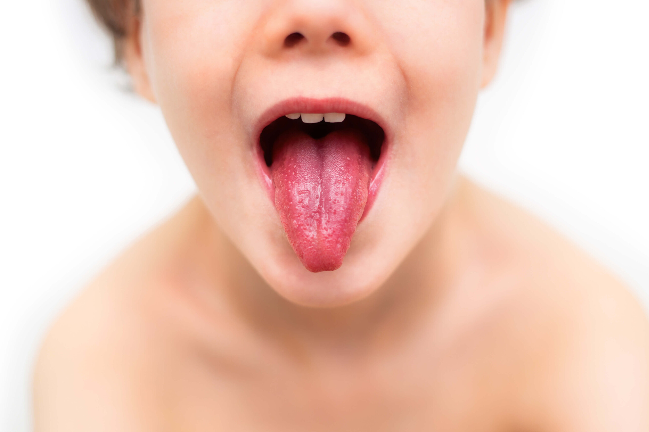 Jak zwalczać zapalenie w jamie ustnej?